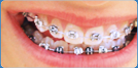 imagem ortodontia